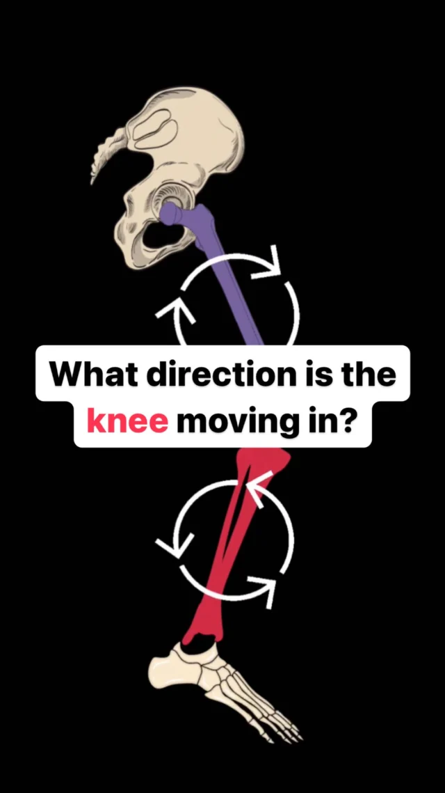 Friday question 🙋‍♀️ 

Imagine that this lower limb was constrained against the ground (closed chain)

Muscular contractions create a rotational effect on the segments that they attach to, and these directions of rotation are shown above at the femur & tibia / shin 

Based on the direction of the rotating arrows, what direction is the knee joint moving into?

A. Knee flexion
B. Knee extension

Let us know what you think below 👇 🙏