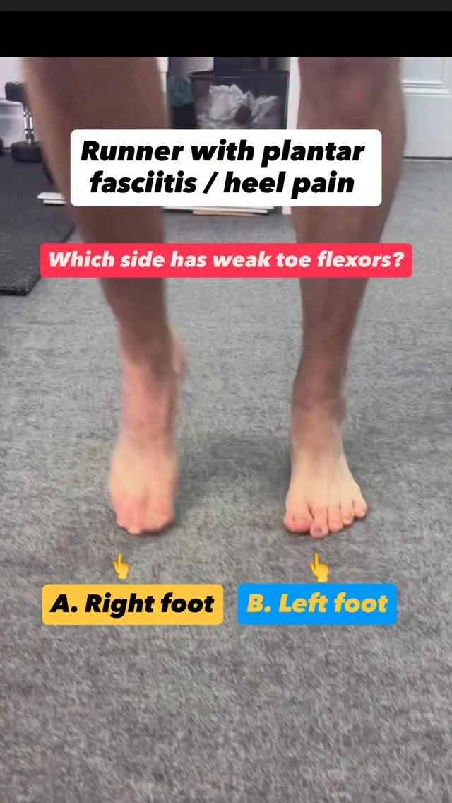 Which side had significant BIG toe flexor weakness during their initial session?
.
.
.
.
.
Answer: Right foot

This client presented with burning heel pain that would refer into their medial arch when running, and during his assessment - we identified STRONG plantar flexors, but WEAK toe flexors 

The solution? We designed a rehab plan to gradually restored toe flexor strength locally & coordinatively integrated this with the rest of the lower limb

Check out our story for one of the coordinative strength / force production strategies we used 

Want to learn more about how we assess & design rehab plans? Then DO NOT MISS OUT on our Black Friday sale coming this Monday 24th 🔥🔥🔥